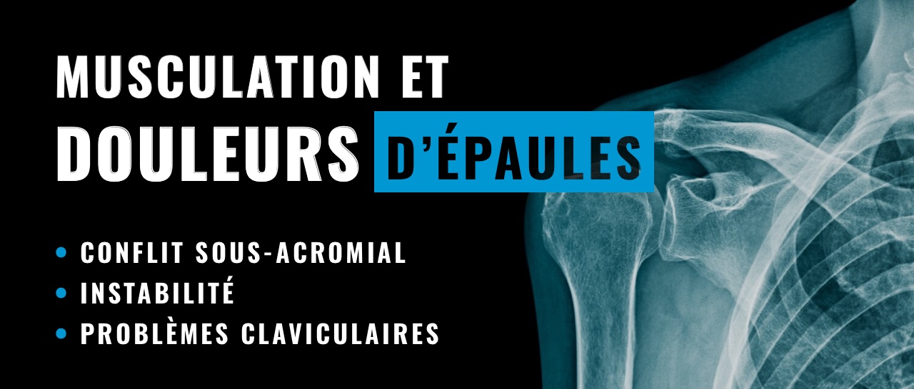 douleurs aux épaules et musculation