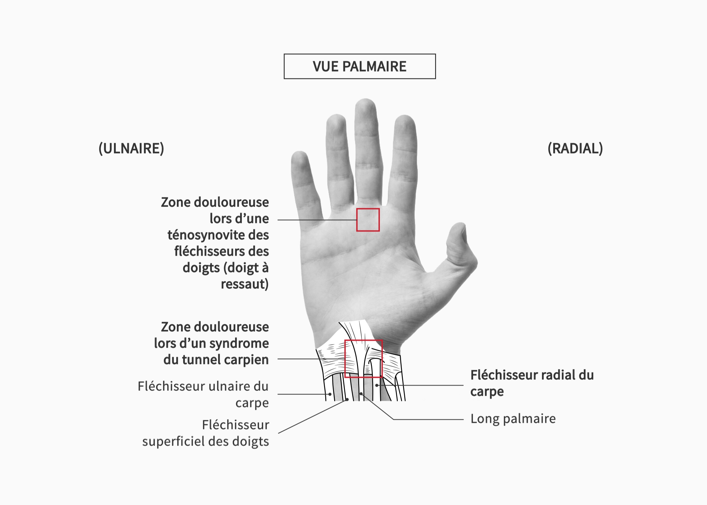 vue palmaire