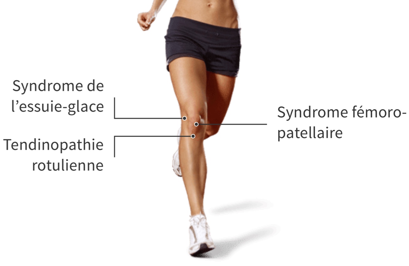 Localisation des trois principales douleurs aux genoux